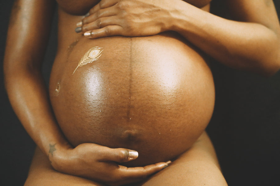 Postpartum Hair Loss in African American Women